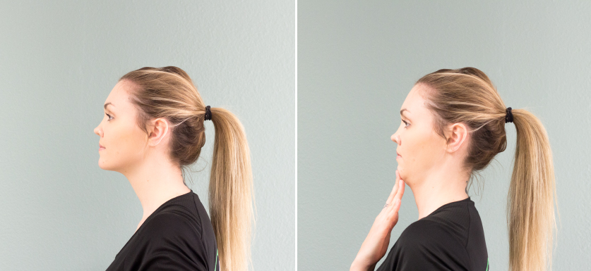 chin tuck exercise